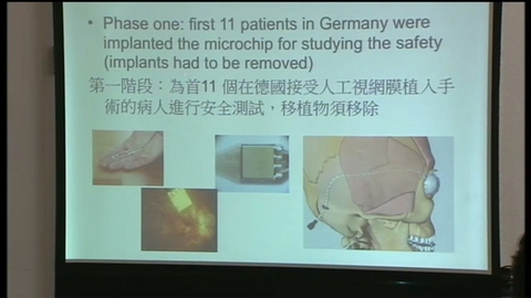 亞洲首宗人工視網膜植入手術