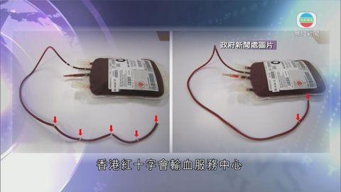 威院女童輸血反應 血包含螢光假單胞菌