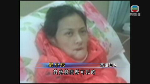 主診醫生指易小玲下顎重建手術成功 主診醫生指易小玲下顎重建手術成功