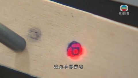 醫療：激光袪斑存風險 能量不當或傷皮膚