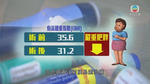 醫療：中大醫學院引入新手術治療糖尿病