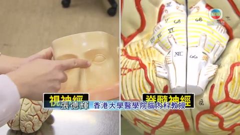 醫療:脊髓眼神經發炎症 發病快復發性高 醫療:脊髓眼神經發炎症 發病快復發性高