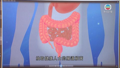 中大研以糞便微生物治療「難辨梭菌」感染