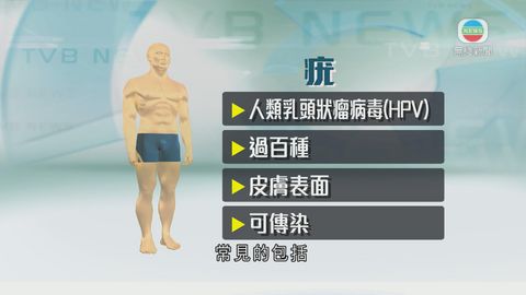 醫療：若皮膚長「疣」數量多 建議求醫