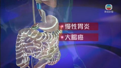 醫療:醫生指心理配合藥物治療 可加強戒酒效果 醫療:醫生指心理配合藥物治療 可加強戒酒效果