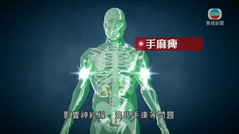 醫療:醫生指改善坐姿 可紓緩「頸梗膊痛」 醫療:醫生指改善坐姿 可紓緩「頸梗膊痛」