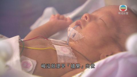 早產嬰23周能存活 惟周數越早嬰兒健康隱憂越多 早產嬰23周能存活 惟周數越早嬰兒健康隱憂越多