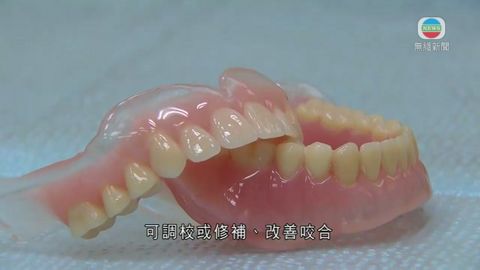 醫療:牙醫指長期戴不合身假牙 易患牙托性口炎 醫療:牙醫指長期戴不合身假牙 易患牙托性口炎