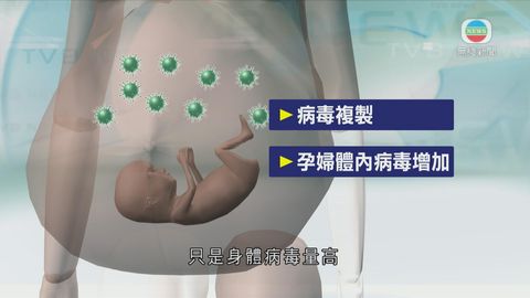 醫療：公院新療法治乙肝帶菌孕婦 減胎兒感染率