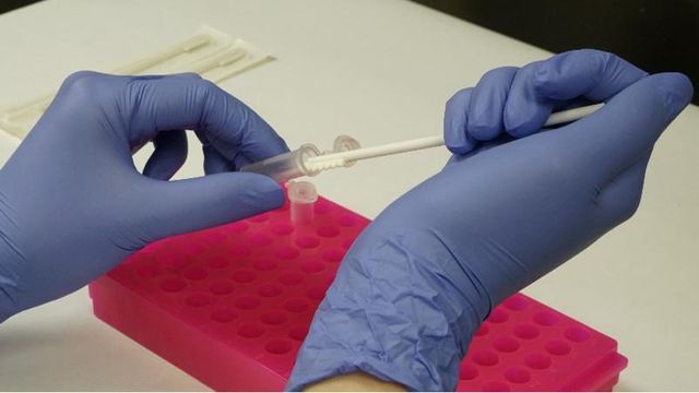 DNA口腔拭子採樣　助尋回親屬的科學鑑證方法｜延伸閱讀