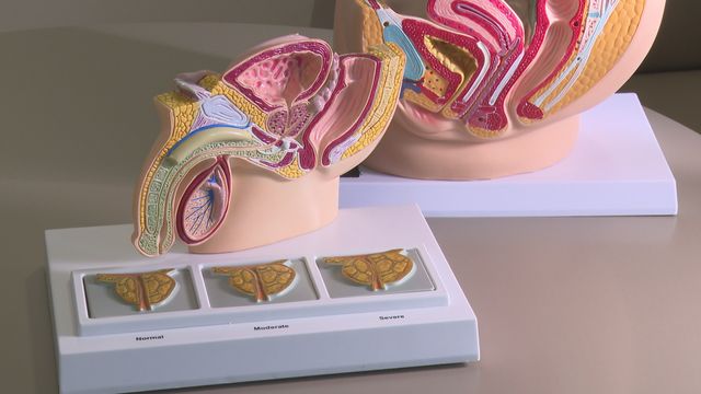 認識前列腺癌：從成因、症狀到治療與自救｜最強生命線‧延伸閱讀