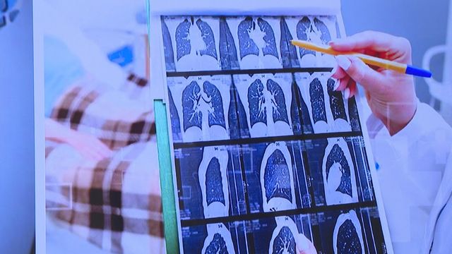 認識「心房顫動」 常見心律不整增中風風險五倍|最強生命線‧延伸閱讀 認識「心房顫動」 常見心律不整增中風風險五倍|最強生命線‧延伸閱讀