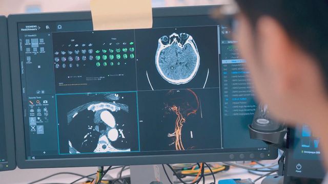 「談笑用兵」可以協助及早識別中風？｜延伸閱讀