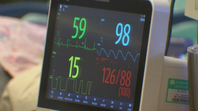 心源性猝死 每10萬港人平均31人病發|延伸閱讀 心源性猝死 每10萬港人平均31人病發|延伸閱讀