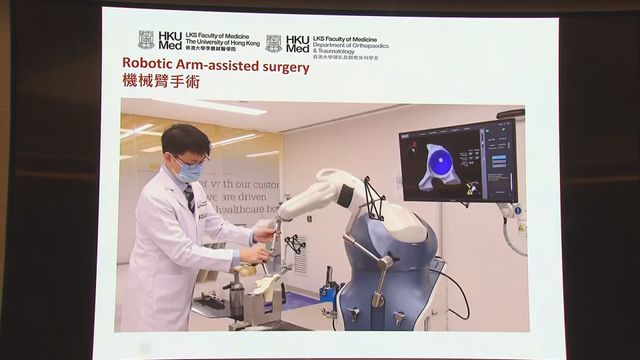 HKU uses robotic arm for better hip replacement surgery