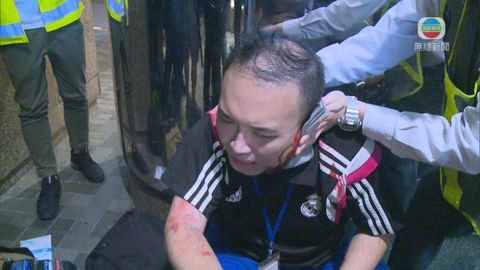東區區議員趙家賢被人咬掉左耳 已完成接駁手術