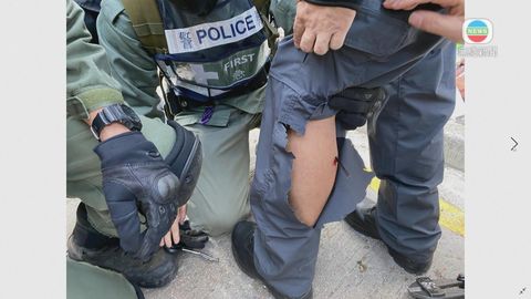 警方社交網站圖片：漆咸道南一名警員左小腿中箭受傷